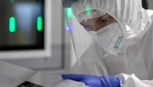 Koronavirüs bitmeden başka salgın mı başlıyor? Dağ sıçanı yiyen kadında "bubonik veba" tespit edildi