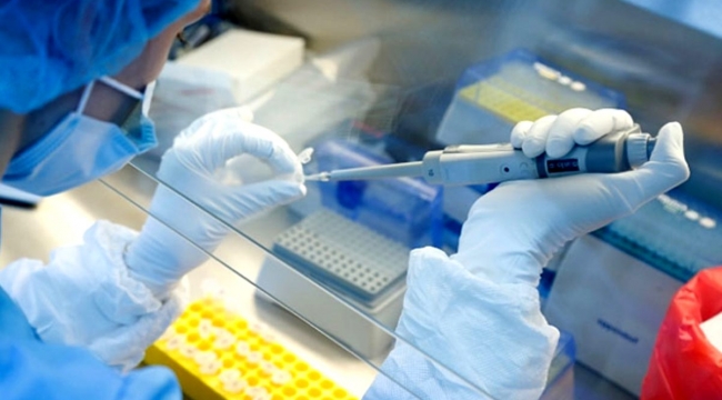 Oxford'un koronavirüse karşı geliştirdiği aşıyı gönüllü olarak deneyen doktor hayatını kaybetti