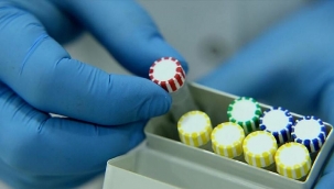 Uluslararası bilim insanı grubu, yeni tip koronavirüs (Kovid-19) salgınına yol açan SARS-CoV-2 virüsüne karşı insan vücudunda üretilen yeni antikorların parçalarını tespit etti.