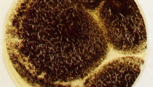 Arjantin'de ilk Kara Mantar vakası açıklandı