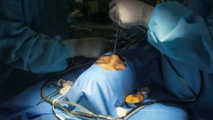 Tek göz çıkarılırsa hayatta kalınıyor! Kara mantar hastalarının yeni fotoğrafları geldi