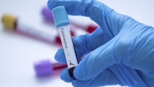 Bugünkü koronavirüs vaka tablosu açıklandı mı? 6 Aralık 2021 vaka ve ölüm sayısı