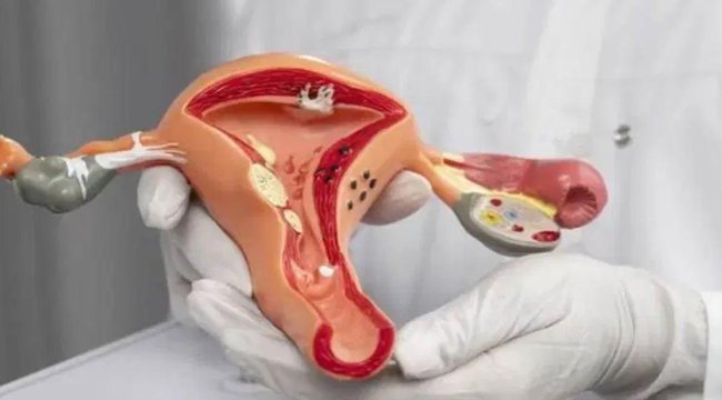 HPV aşısı serviks kanserinden koruyor