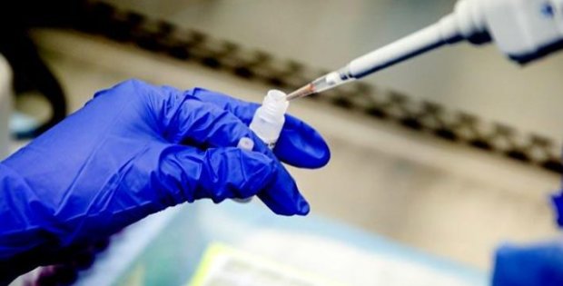 ABD Gıda ve İlaç İdaresi, 2 dakikada sonuç veren koronavirüs testine onay verdi