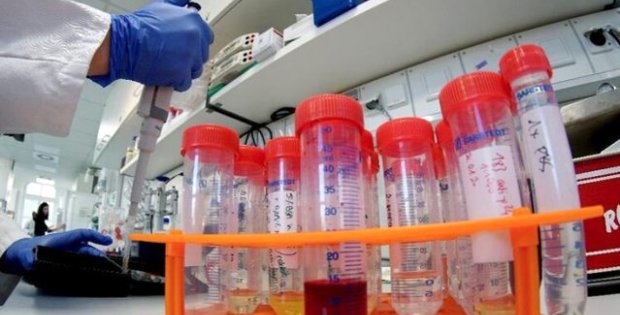 Bilim insanlarından hayat kurtaracak araştırma! Kovid-19, plastikte tam 3 gün yaşıyor