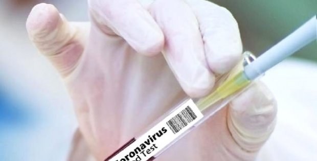 Çin, koronavirüse karşı "yüzde 99 etkili olacak" aşı geliştirdi