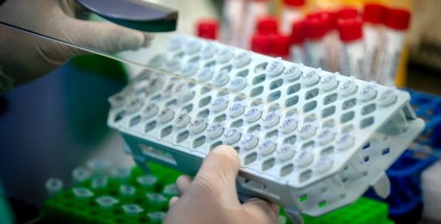 Dünya genelinde yeni tip koronavirüs vaka sayısı 700 bini geçti