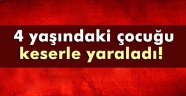 4 yaşındaki çocuğu keserle yaraladı