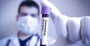 Fransız bilim insanları koronavirüsün 3 yeni belirtisini daha ortaya çıkardı