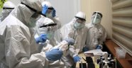 Hong Konglu uzmanlar, koronavirüsün ikinci kez bulaştığını kanıtladı