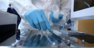İngiltere'nin Çin'den ithal ettiği tanı kitlerinde koronavirüs tespit edildi