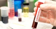 Kan sulandırıcı ilaçlar, koronavirüs hastalarının hayatta kalma şansını yükseltebilir