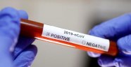 Koronavirüs testi yaptıranlar test sonuçlarına e-Nabız uygulamasından ulaşabilecek