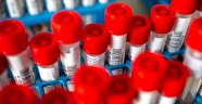 Sağlık Bakanlığı Referans Laboratuvarı'nda koronavirüsün parmak izi çıkarıldı