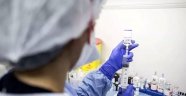 Türk bilim insanları, koronavirüs tanısı için yeni sistem geliştirdi