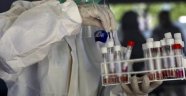 Türkiye'de koronavirüs aşısı için anti serum çalışmaları başladı